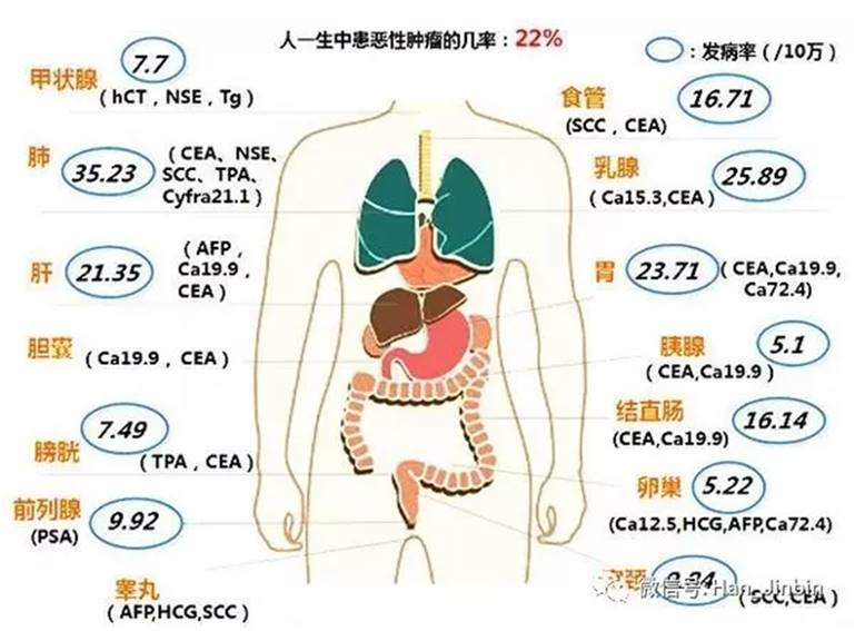 談談腫瘤標誌物和腫瘤的關係