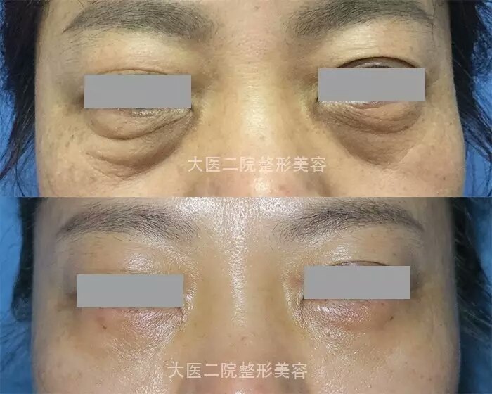 暂无