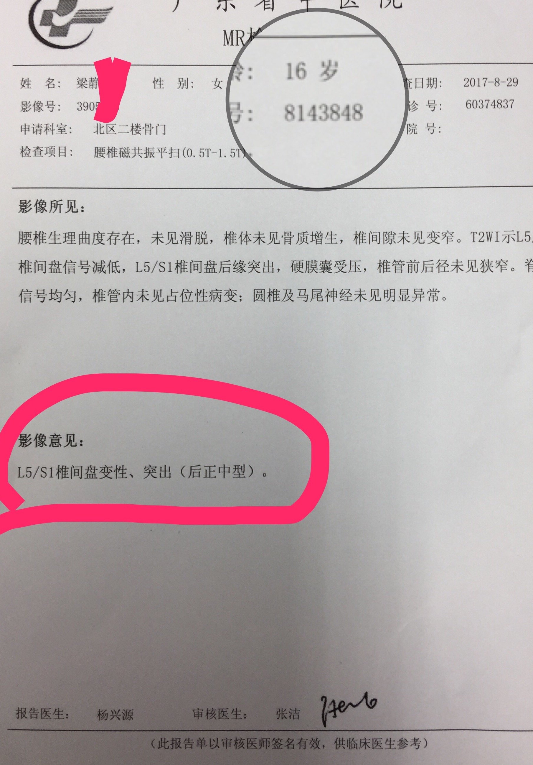 腰椎间盘突出核磁报告图片