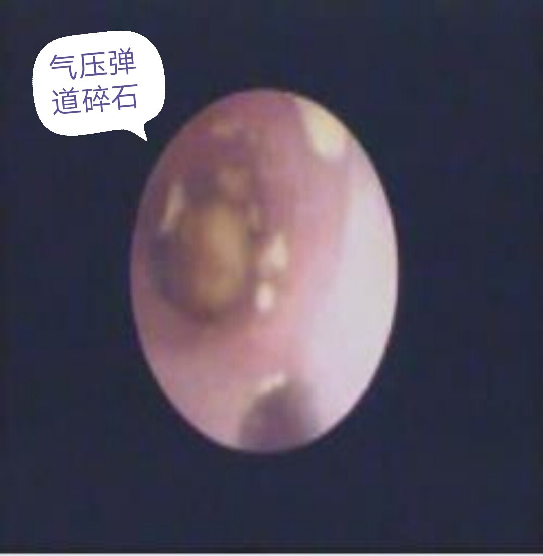 暂无