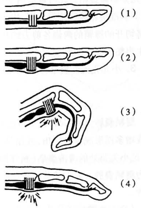 弹簧对手指弹力示意图图片