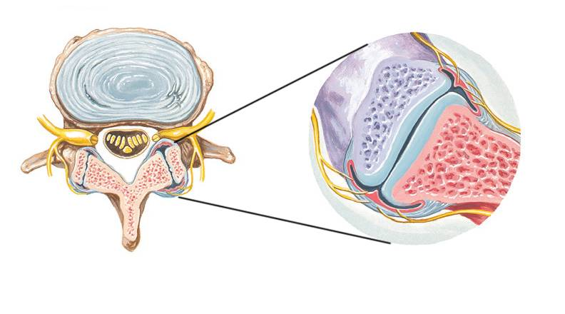 脊椎关节囊图片图片