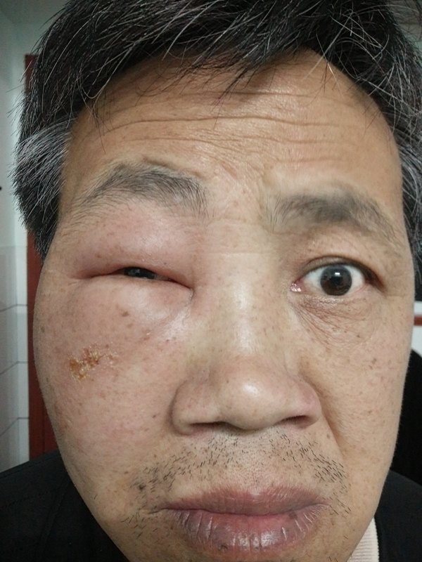 圖文圖片