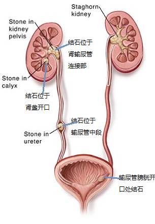 输尿管和膀胱的位置图图片