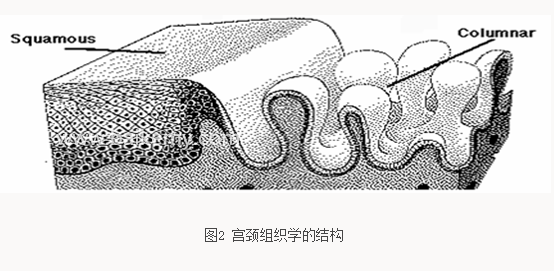 宫颈糜烂——一个过时的疾病 - 好大夫在线