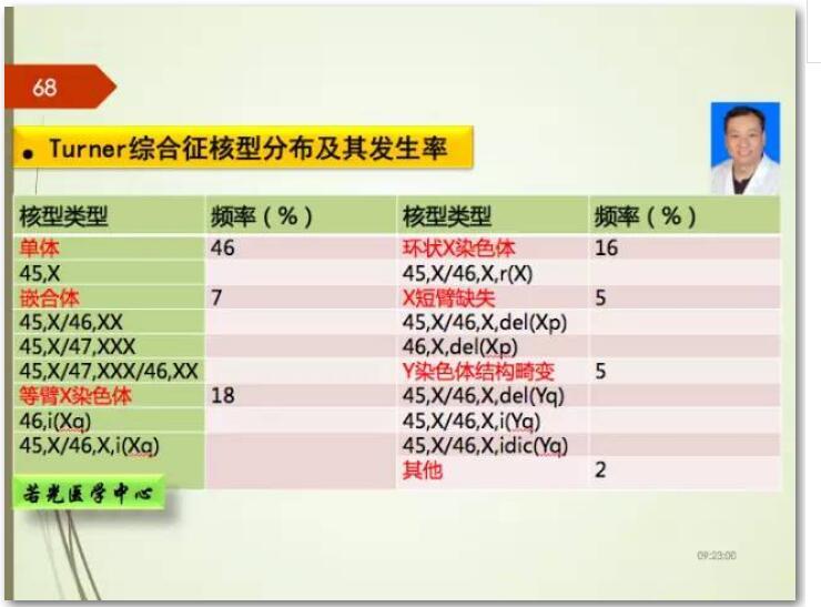 染色體病之特納綜合徵/45,xo - 好大夫在線