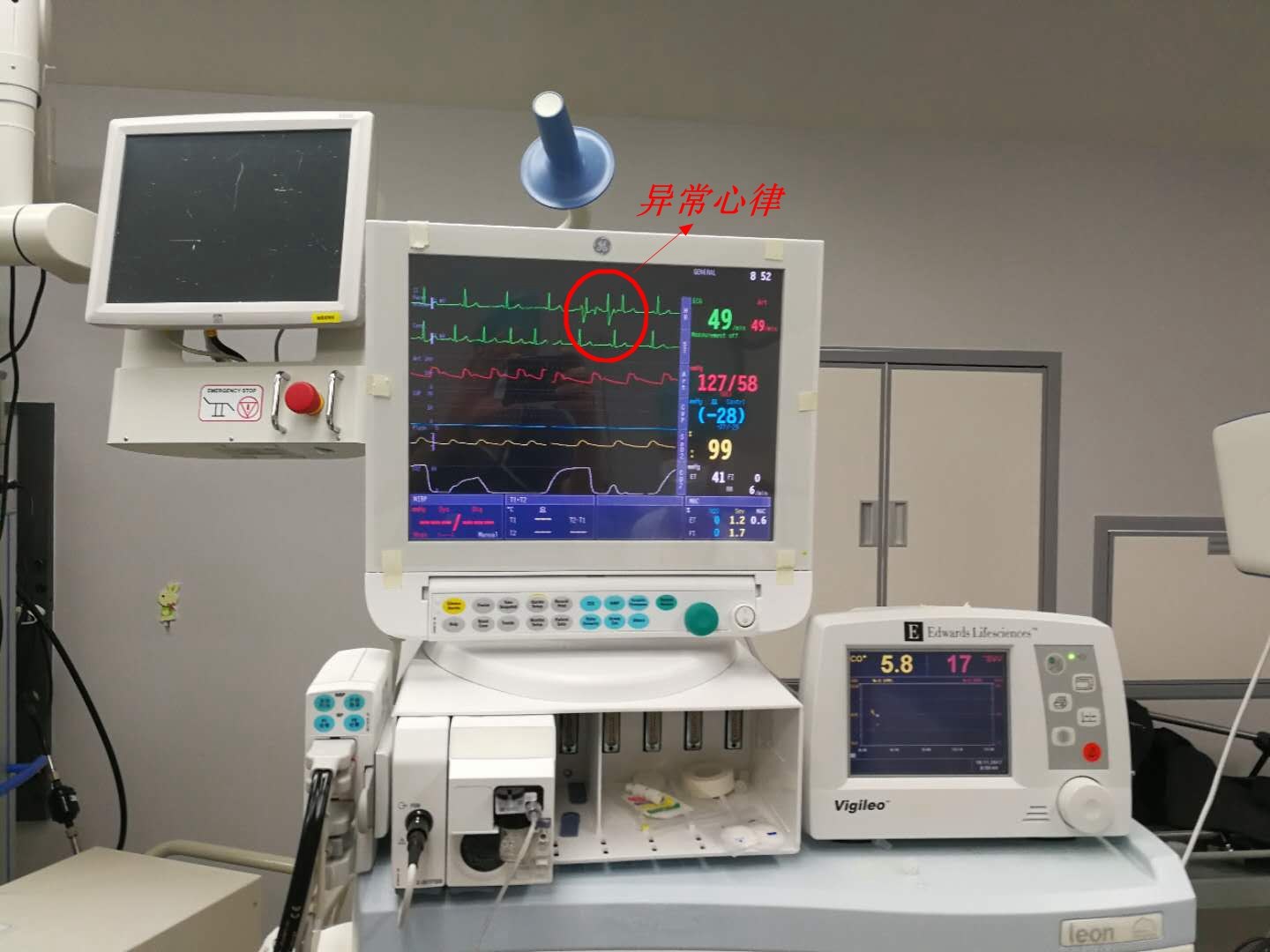 北京友谊医院减重团队圆心脏患者的减重梦 - 好大夫在线