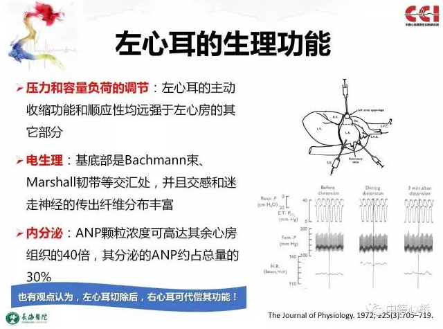 揭开经导管左心耳封堵术的身世之谜