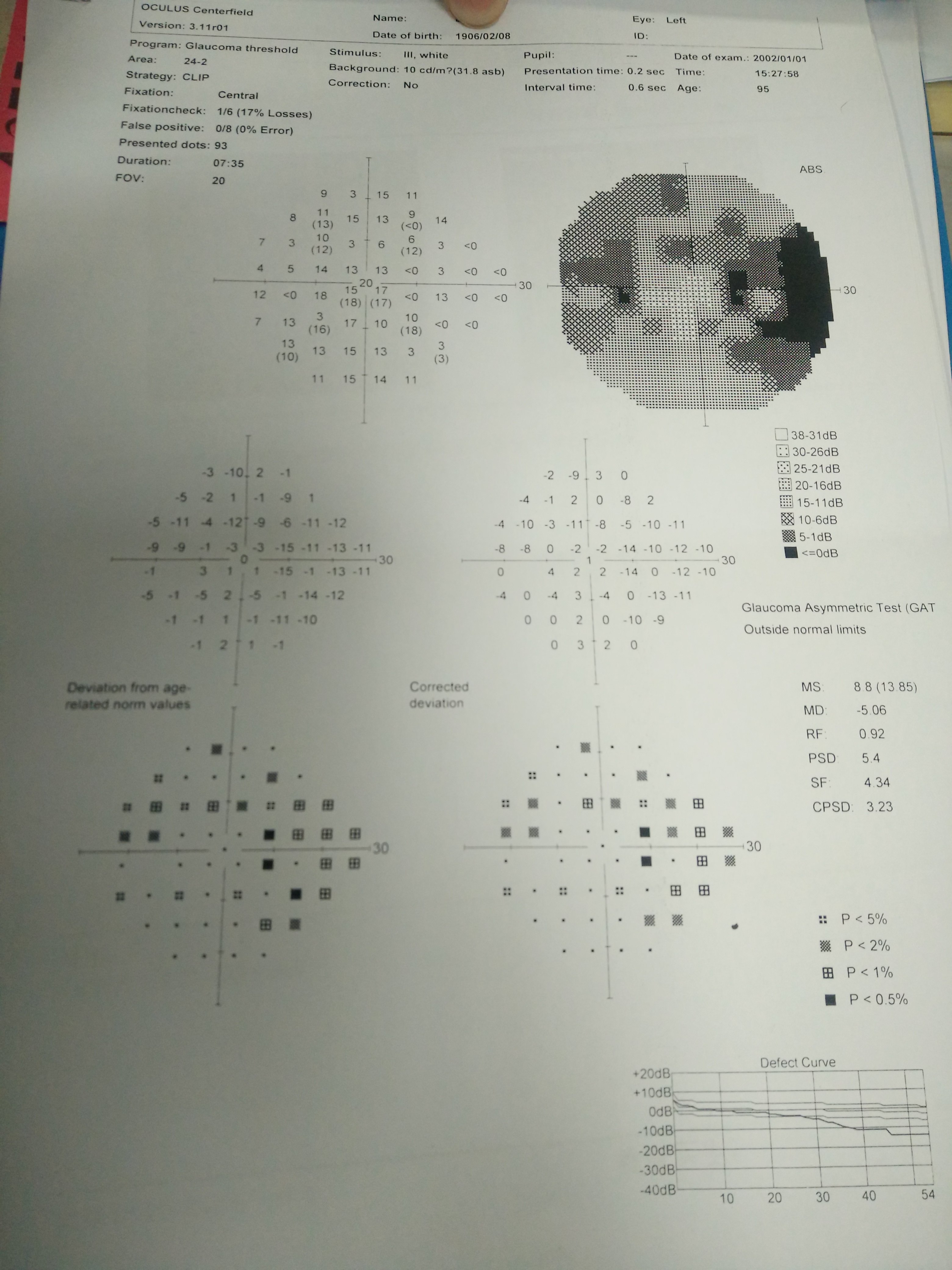 外院左眼视野的结果眼部b超双眼视神经黄斑oct接上眼底造影结果