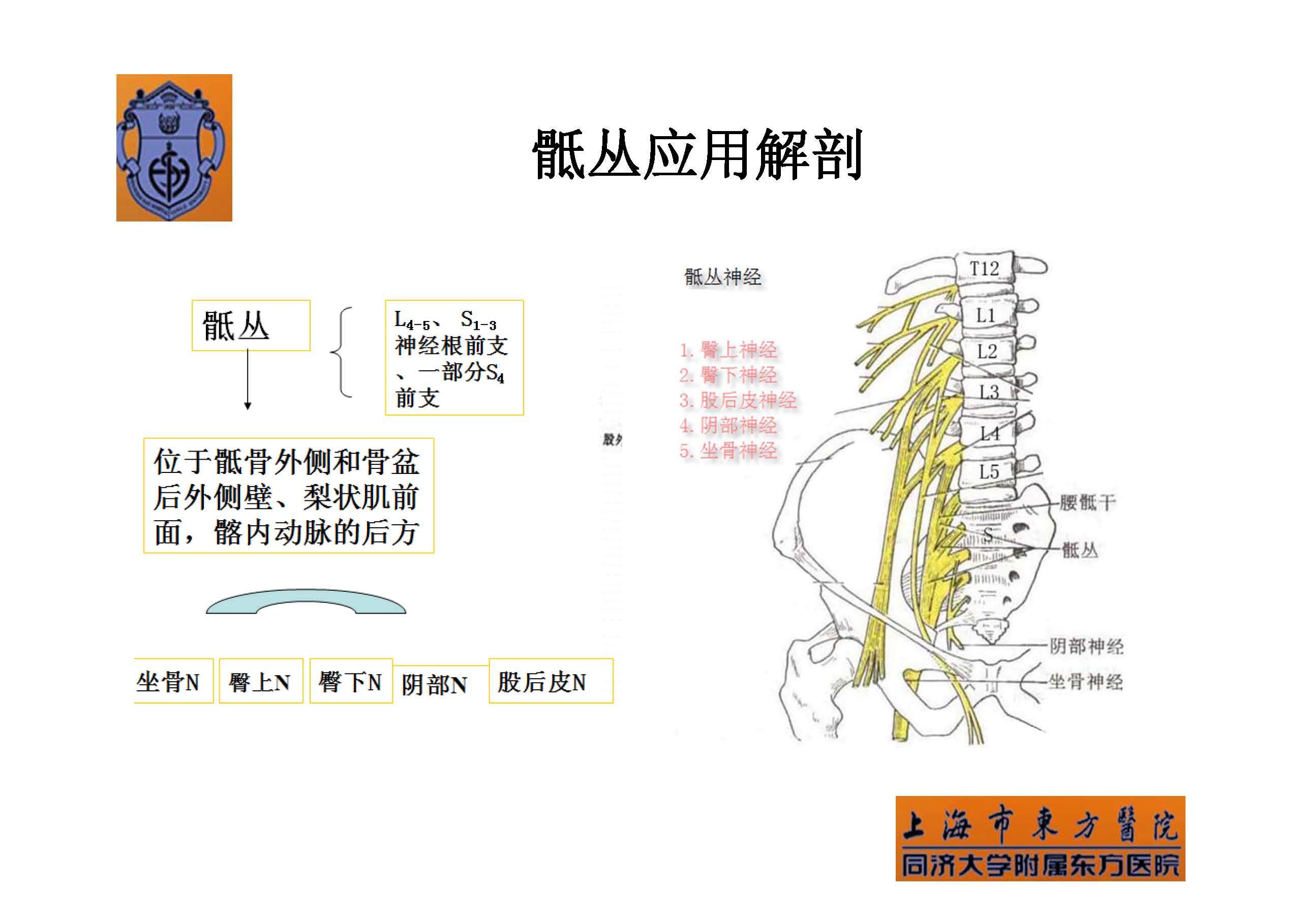 骶丛神经阻滞图片