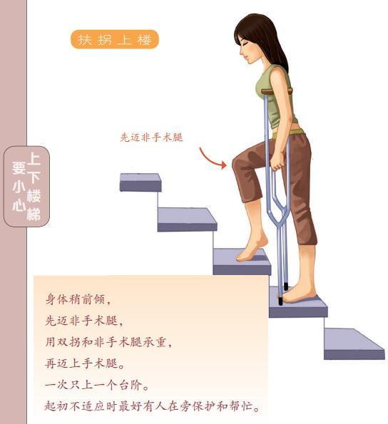 对于术后六周以内的朋友,我们建议扶双拐上下楼.