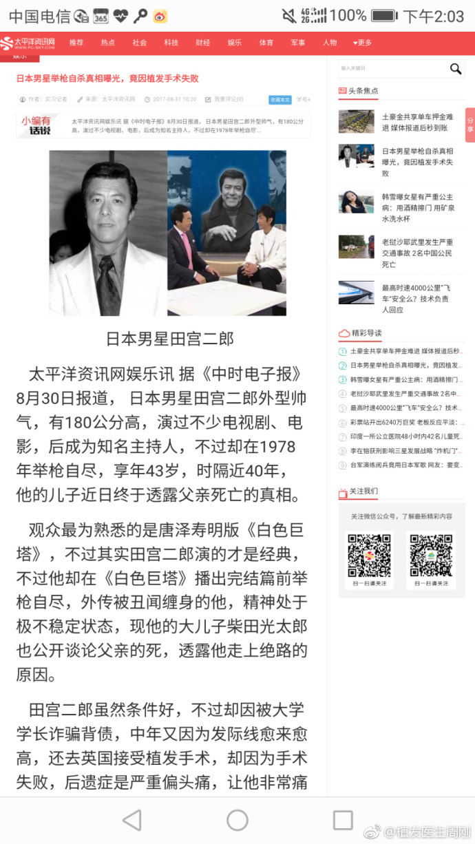 澄清系列第四季:植发手术会引起偏头痛吗?!