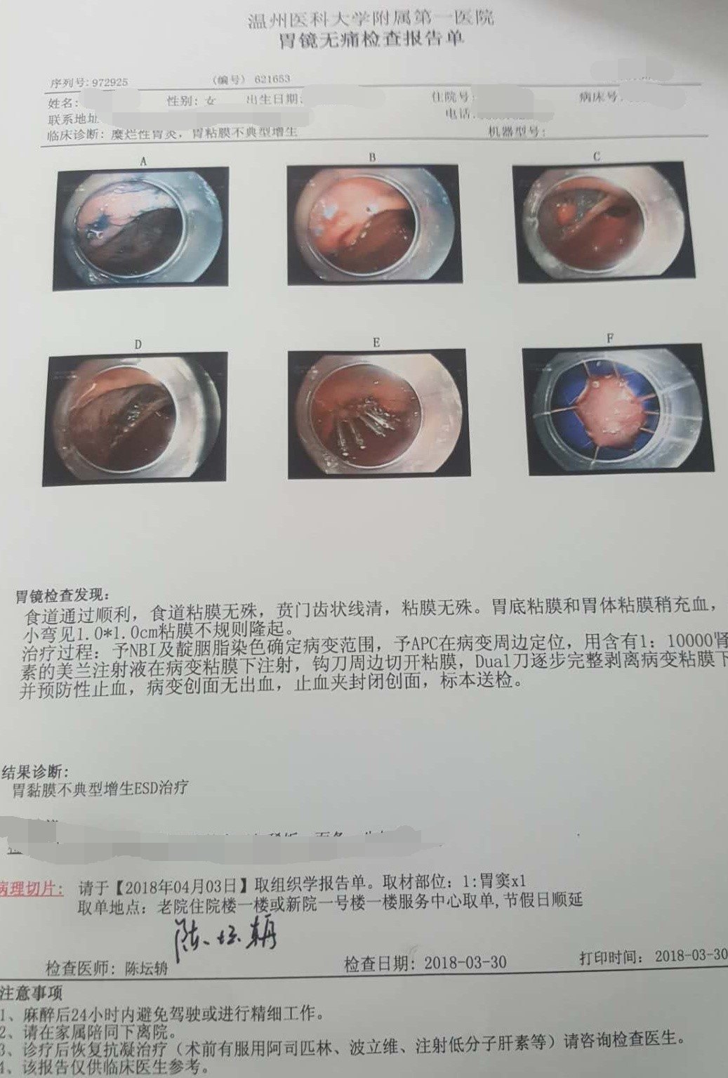 重度肠化 m.haodf.com