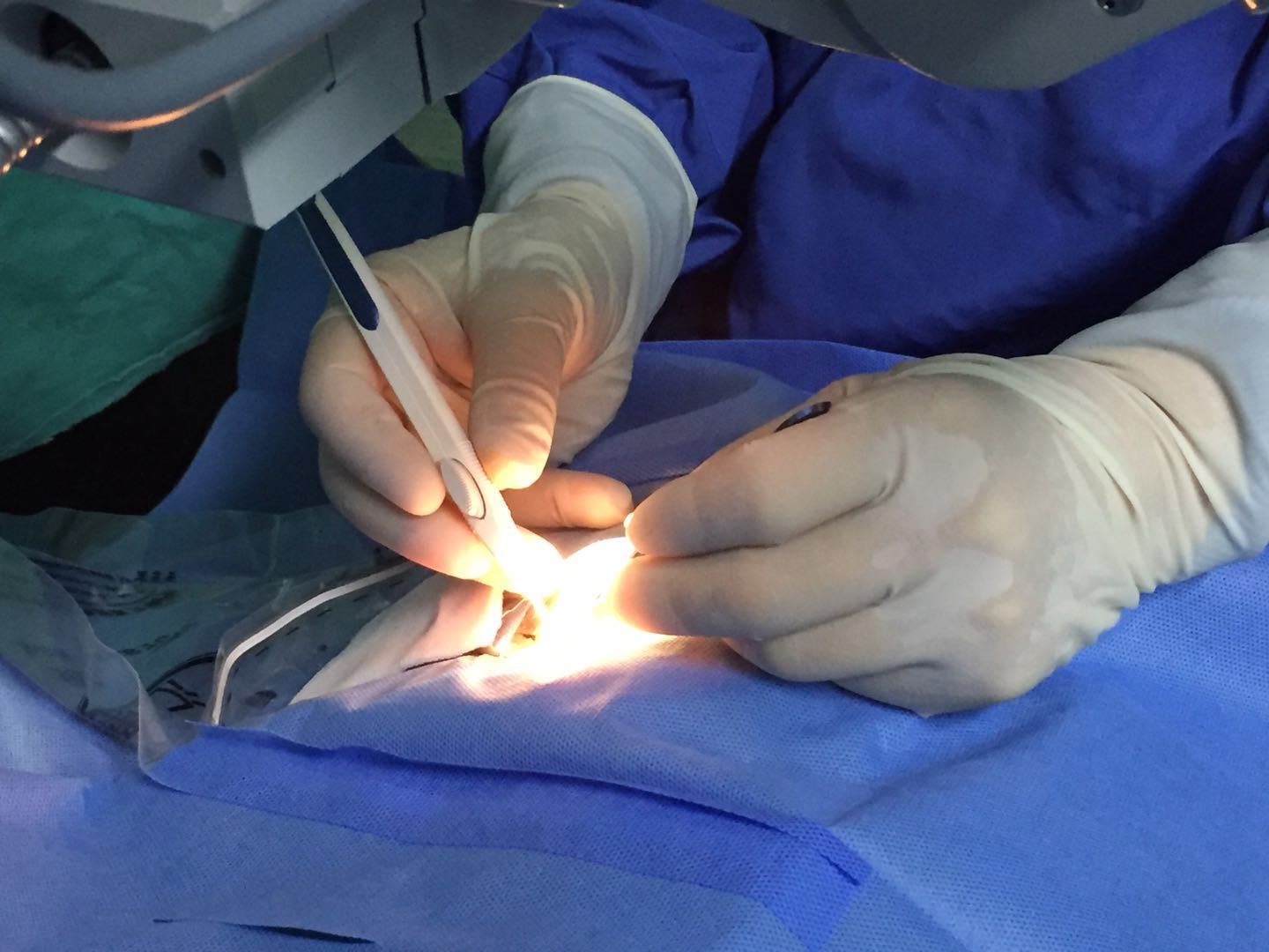 药物治疗手段有限,主要为玻璃体腔注射抗血管内皮生长因子(vegf)药物