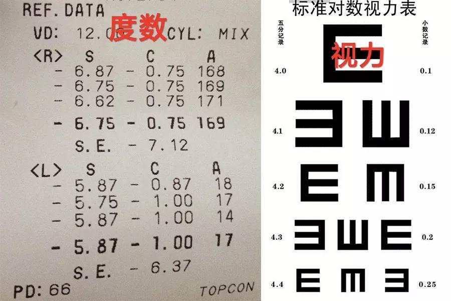 科普:度数和视力的区别与联系 - 好大夫在线