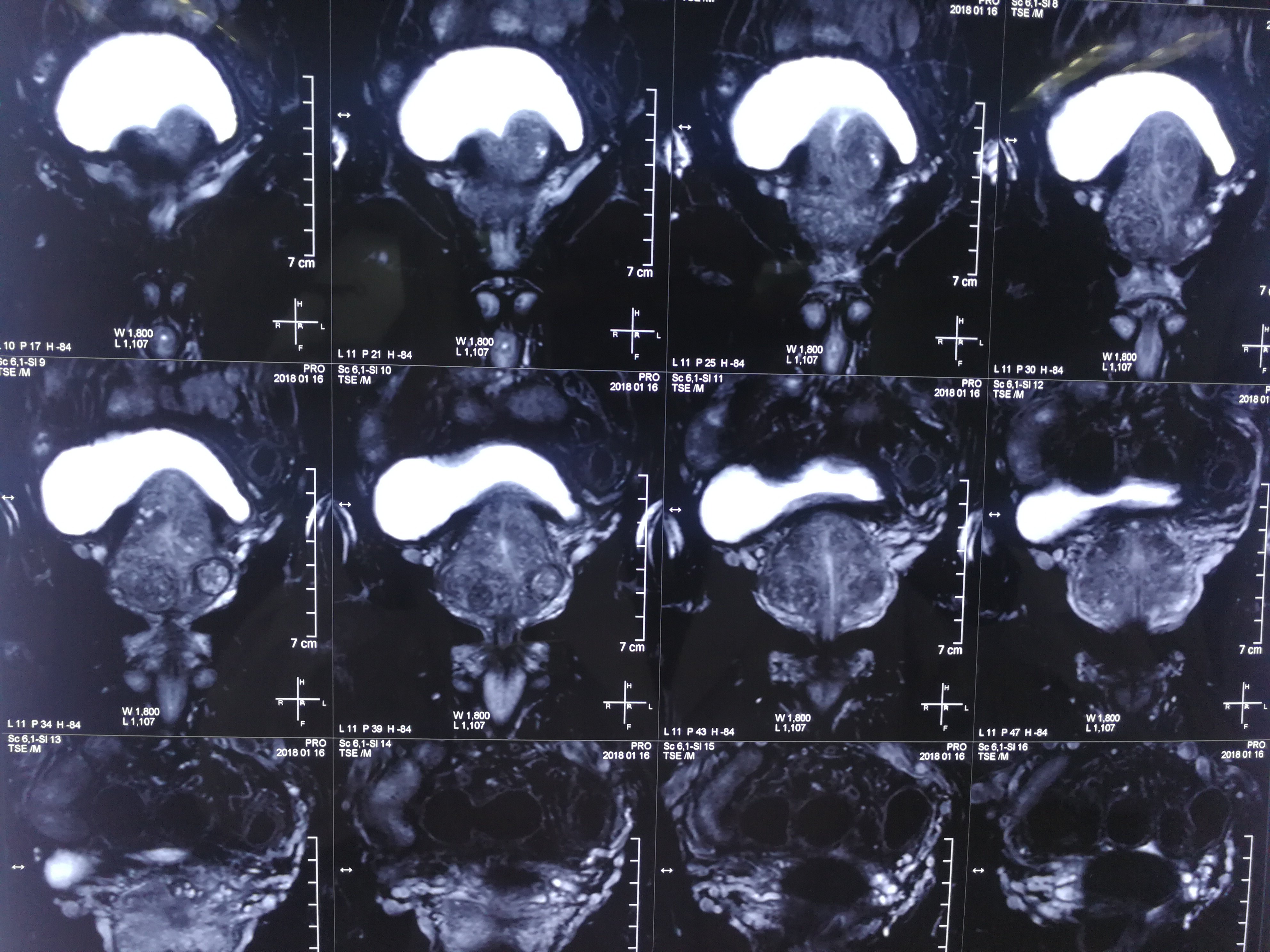 北京胸科医院挂号流程核磁加急-北京胸科医院核酸检测需要预约吗 北京胸科医院挂号流程核磁加急-北京胸科医院核酸检测需要预约吗