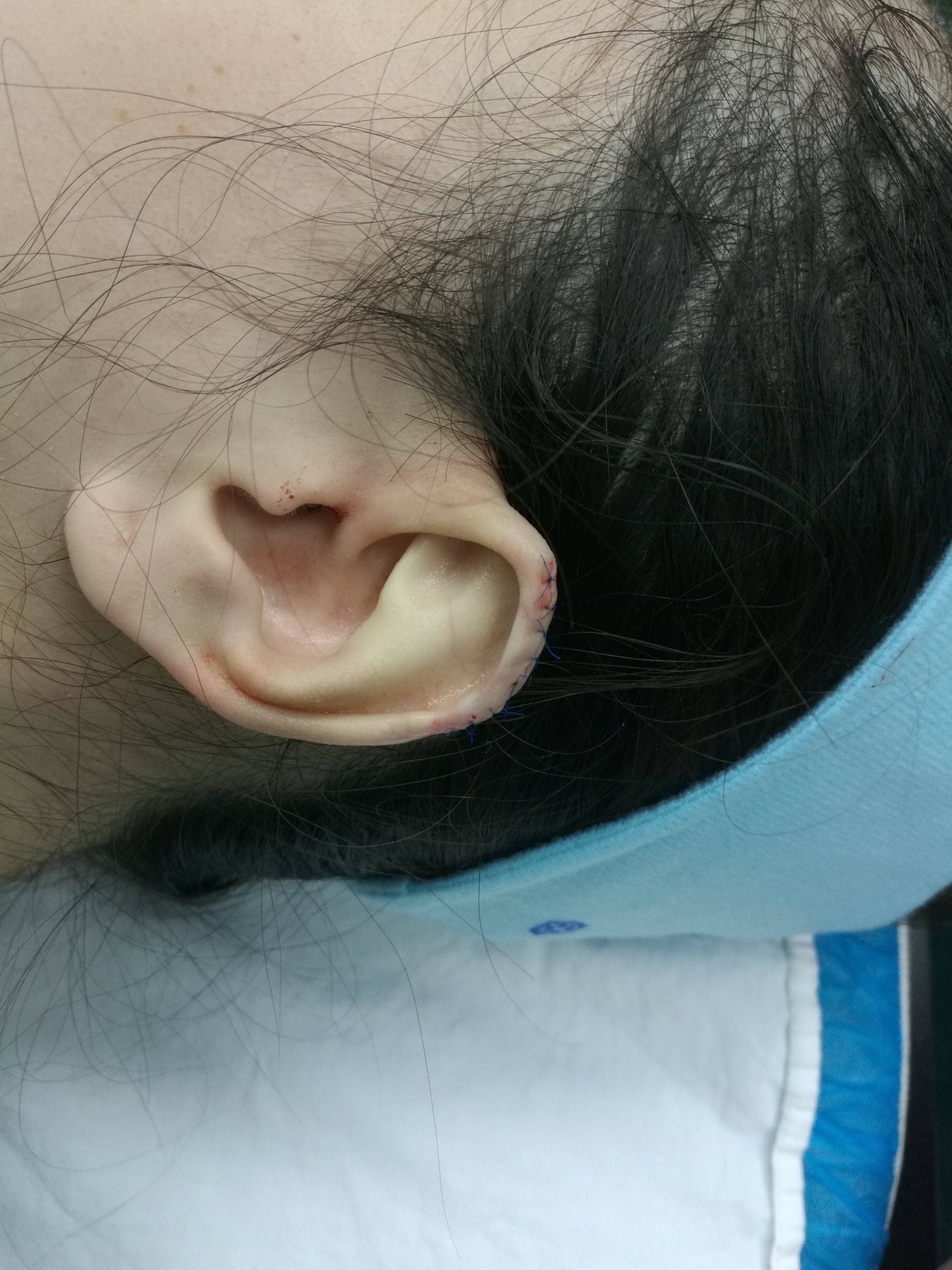 耳朵长茧子的图片图片
