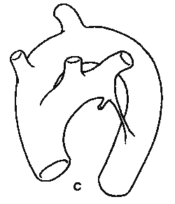 主动脉弓的发育较为复杂,部分血管的发育过程至今仍存在一定的争议.