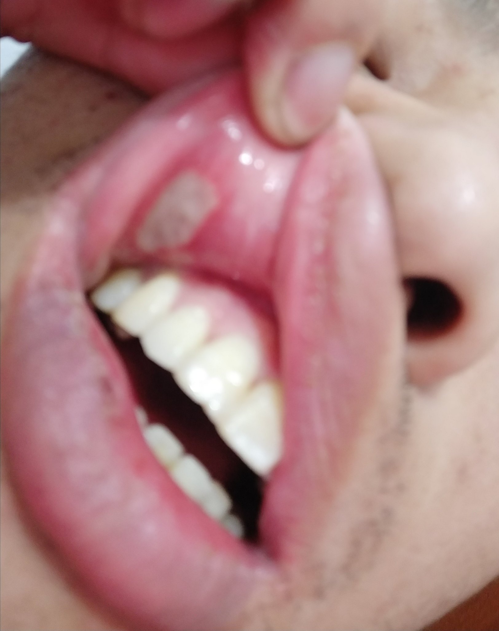 IMG_20180327_185044.jpg