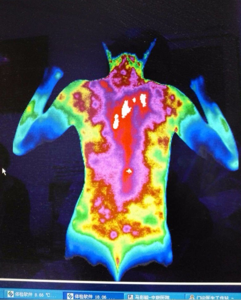 更年期保健与康复--男性更年期综合症