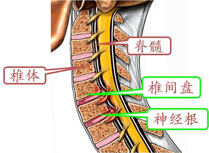 颈托(颈围)的正确使用 - 好大夫在线