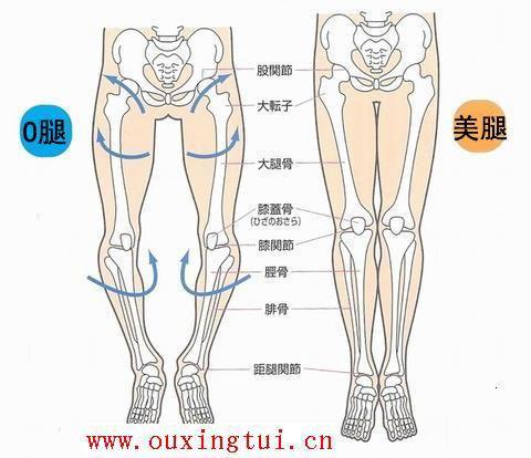 八字脚 X O 型腿调整方案