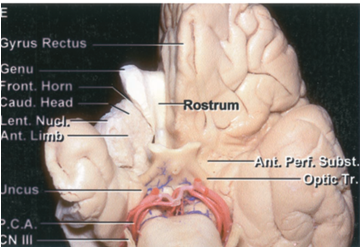 前纵裂入路解剖 - 好大夫在线