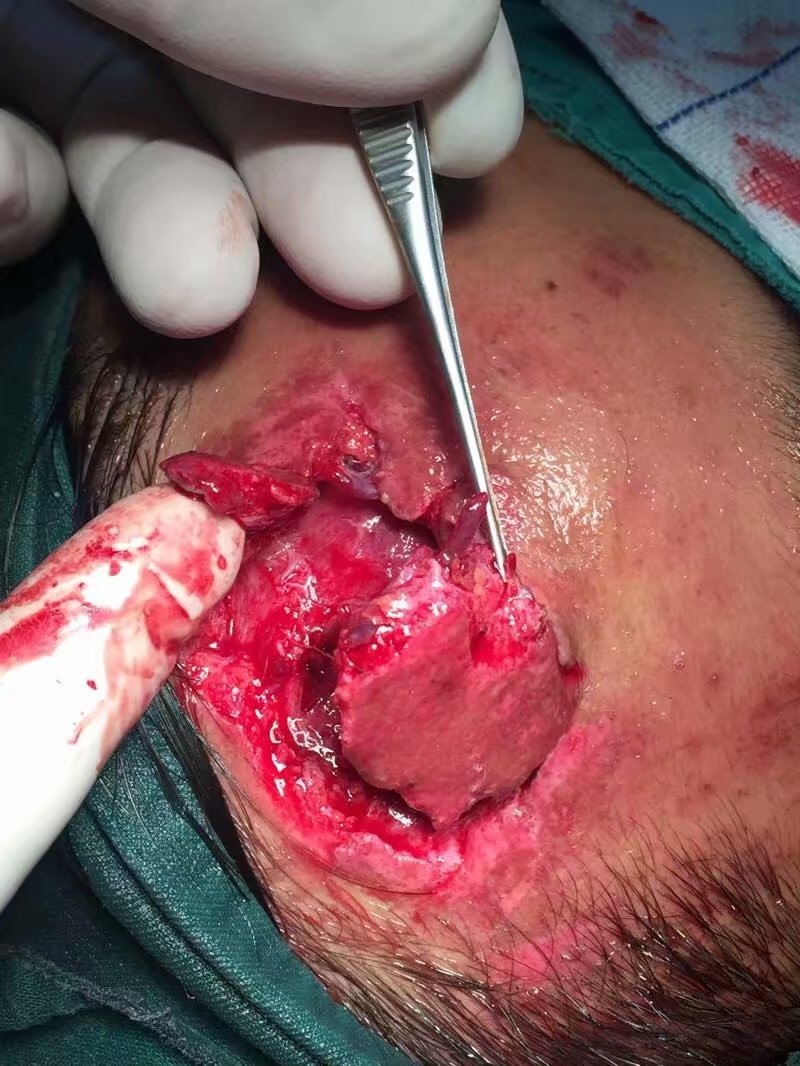 外伤整形美容缝合 - 好大夫在线