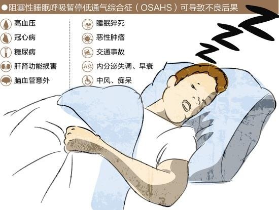 成人阻塞性睡眠呼吸暂停多学科诊疗指南及我们的诊疗经验 睡眠呼吸暂停综合征 睡眠呼吸暂停综合征治疗方法