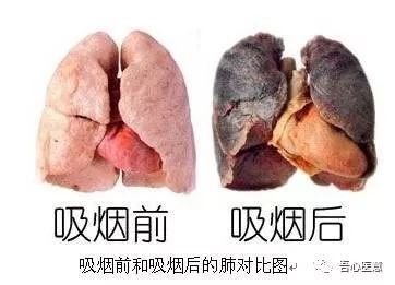 流感来势汹汹危害却被低估_流感的危险性_流感危机