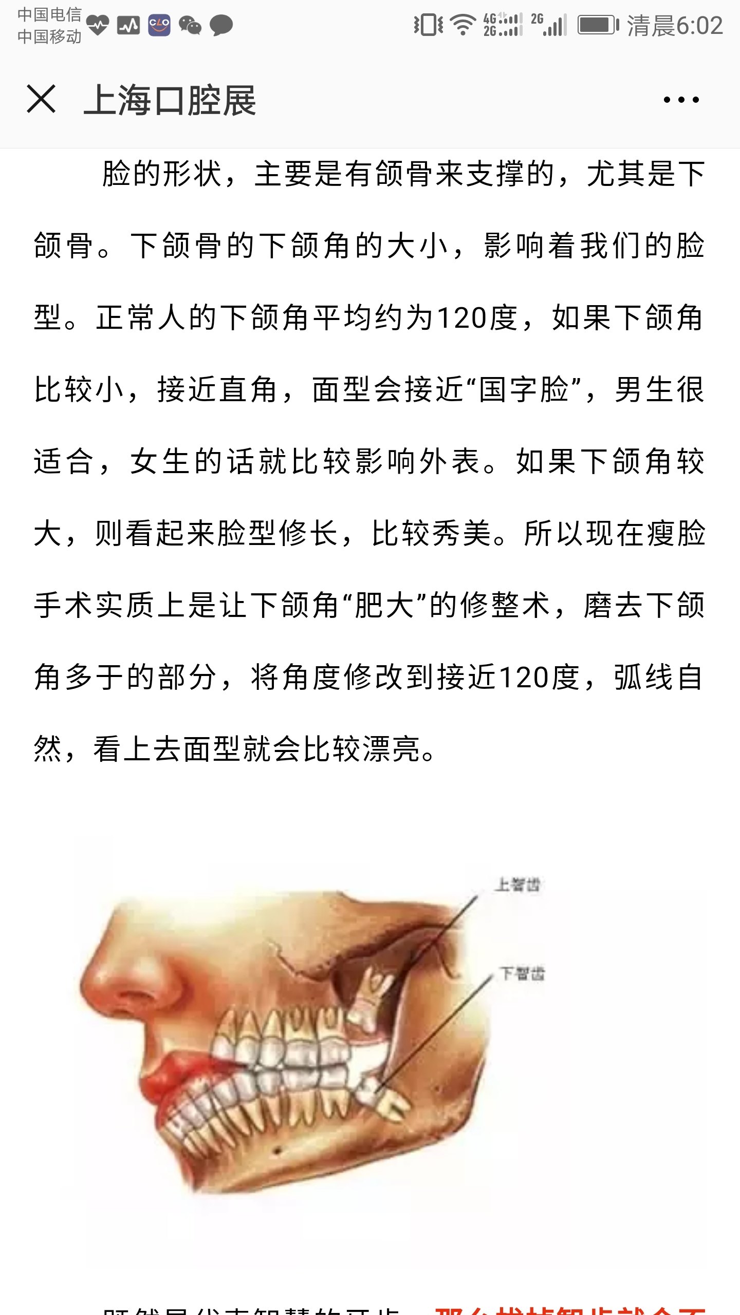 拔智齿真的可以瘦脸吗? - 好大夫在线