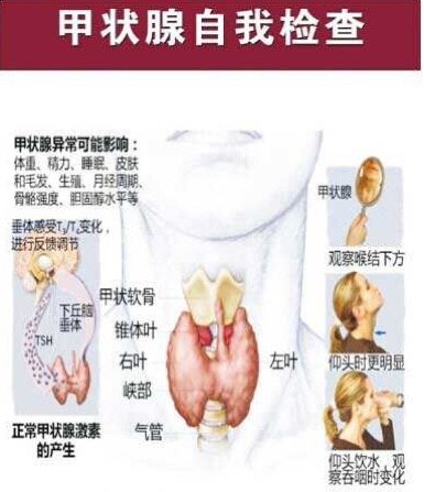 甲状腺自我检查