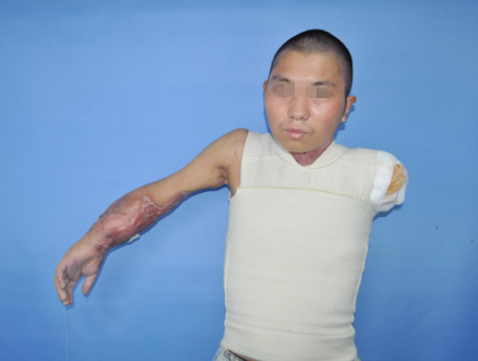 我院烧伤科圆满通过国家临床重点专科总结评估 - 好大夫在线