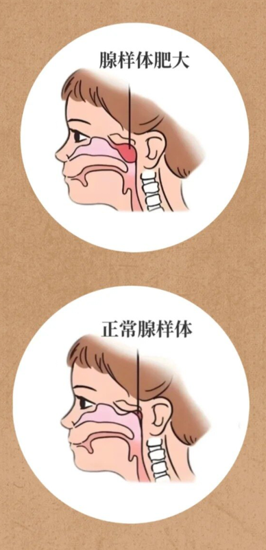 圖文圖片