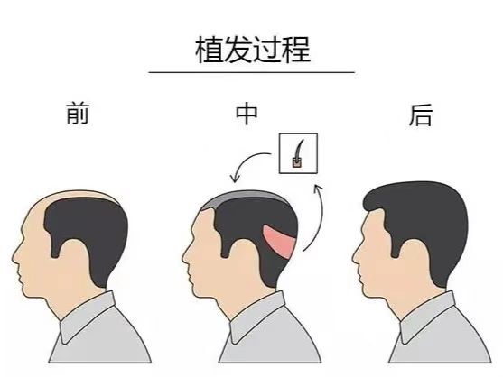 圖文圖片