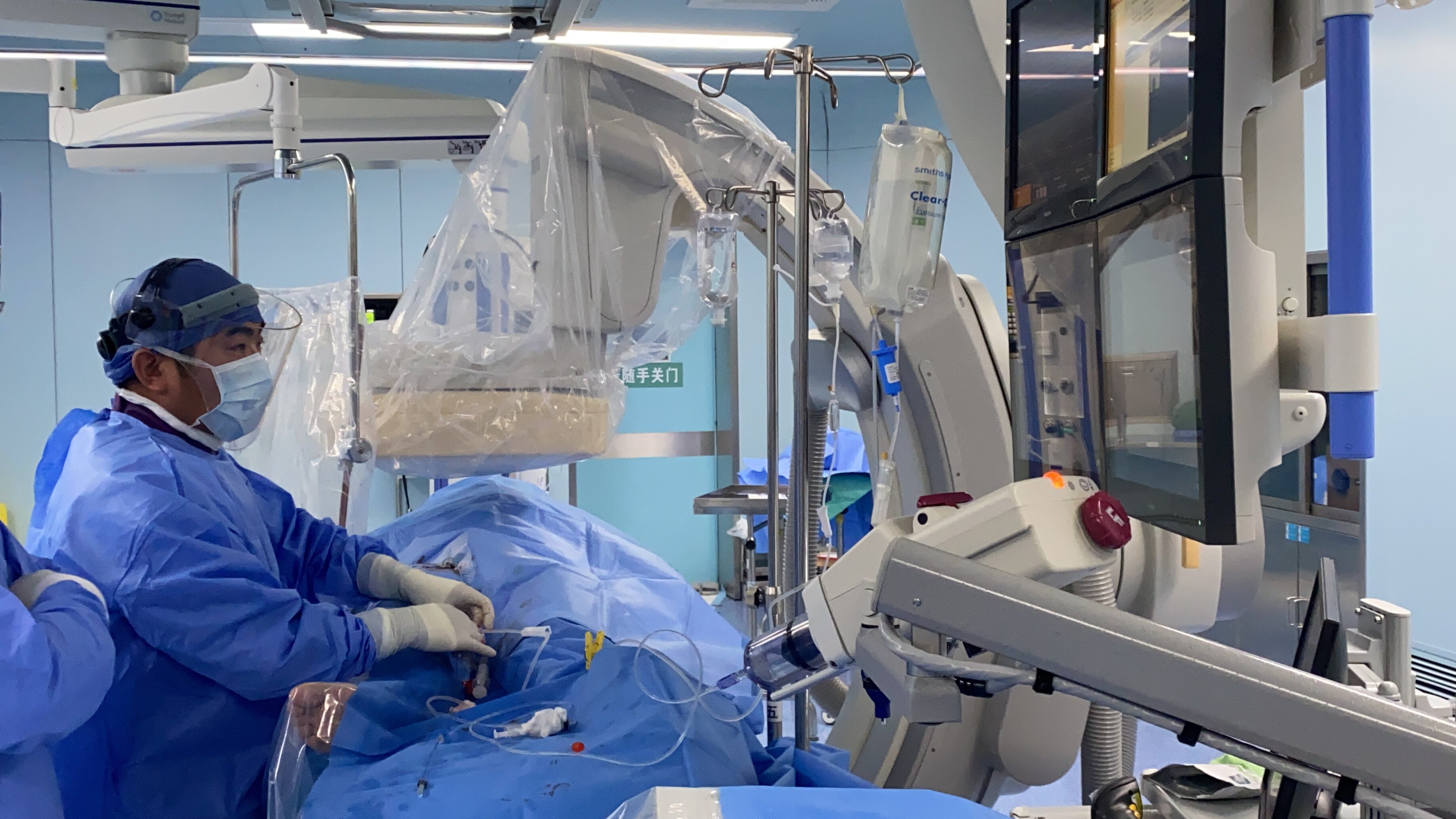 国内第二例肝癌钇90微球治疗手术过程 - 好大夫在线