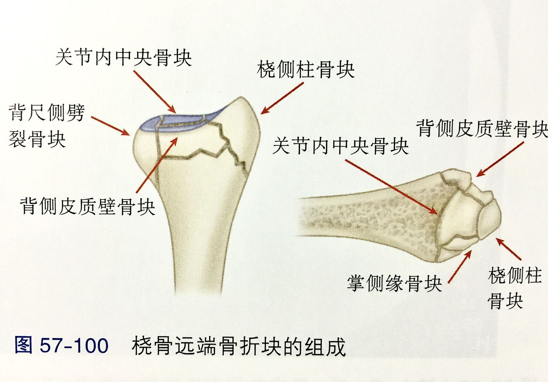 桡骨分水岭解剖图图片