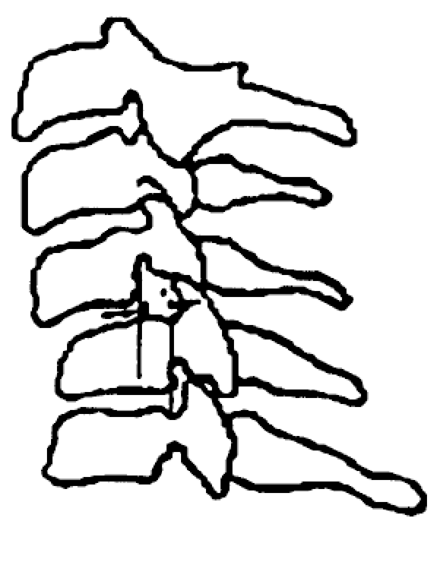 颈椎结构图手绘图片