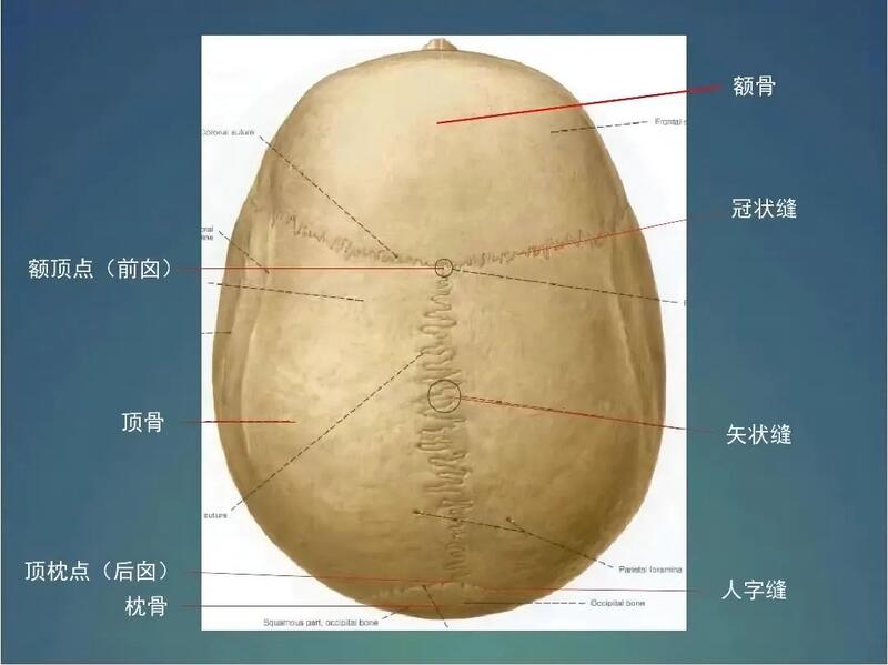 狹顱症