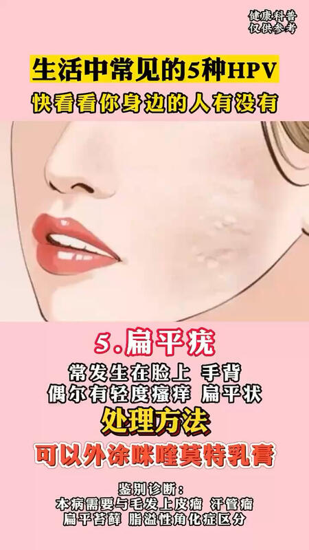 視頻封面