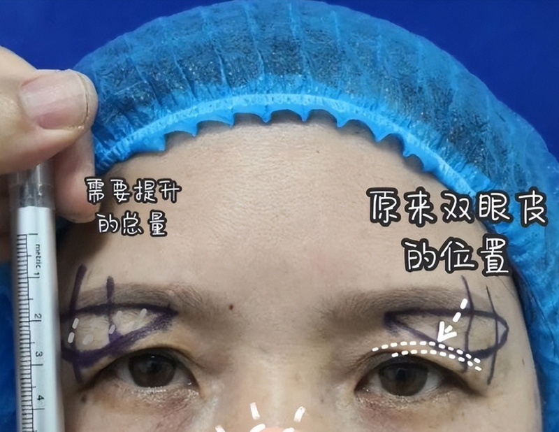 圖文圖片