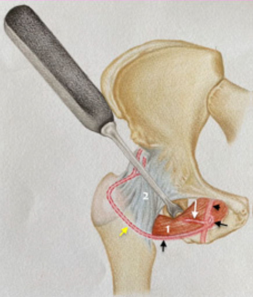 2021年瑞士bern大学:保留股直肌pao髋臼周围截骨术的手术入路解剖