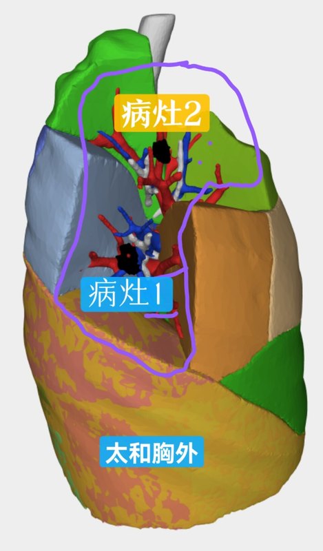 圖文圖片