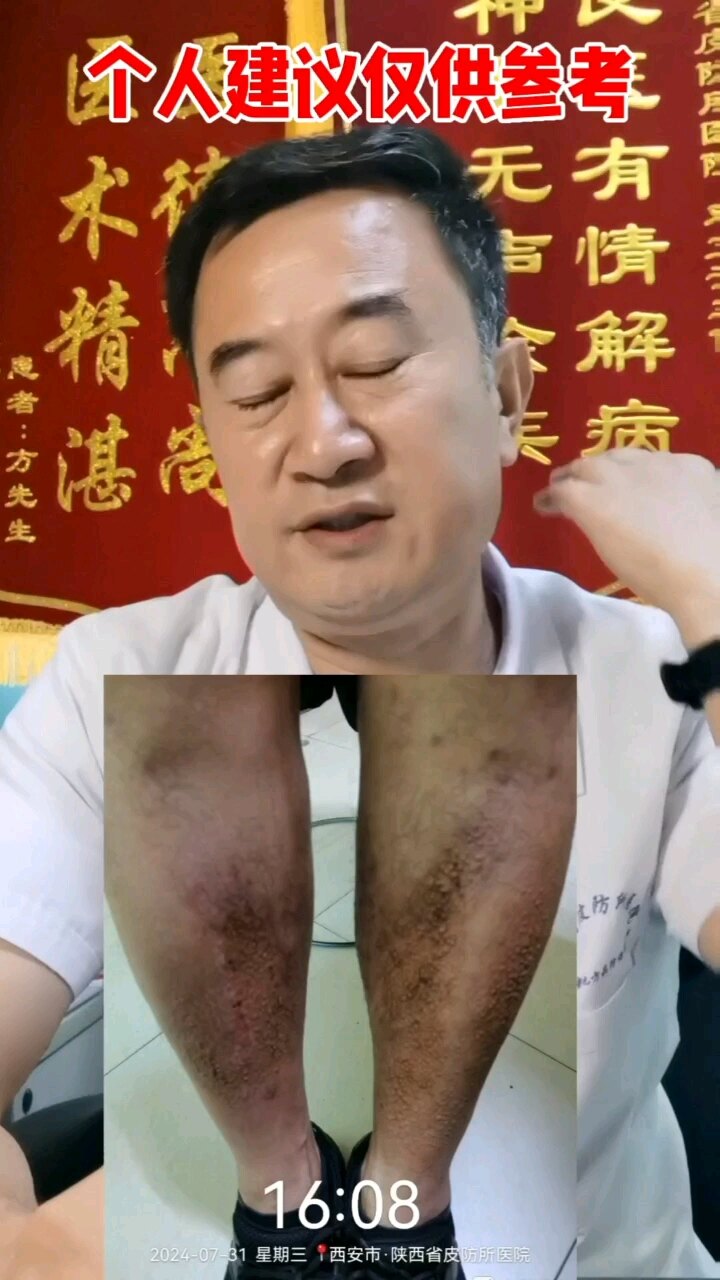 默认图片