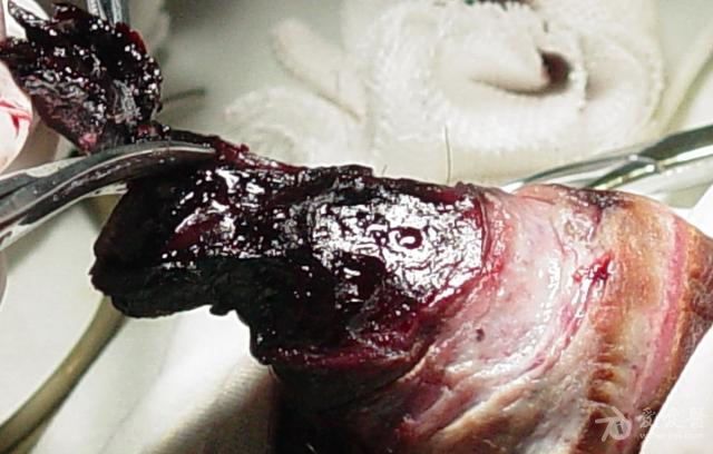 包皮水肿怎么办? - 好大夫在线