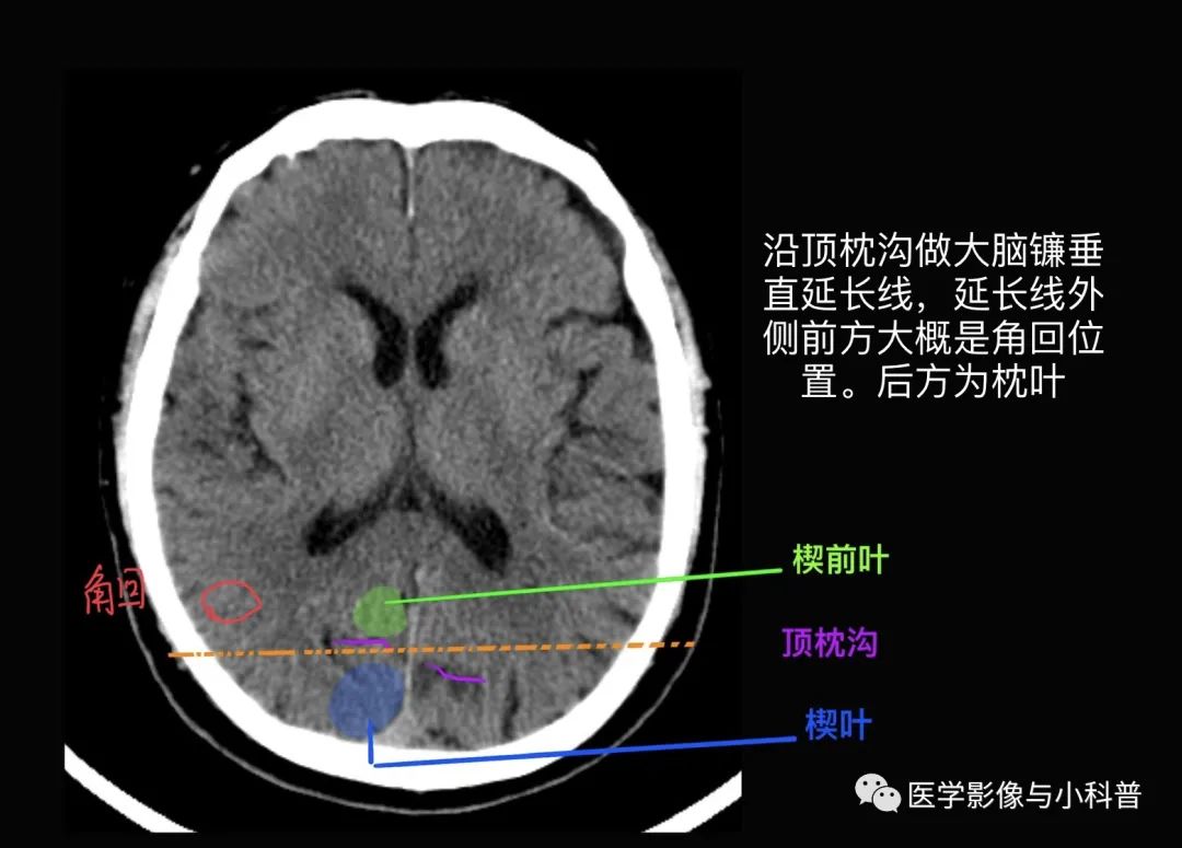 顶下小叶角回图片