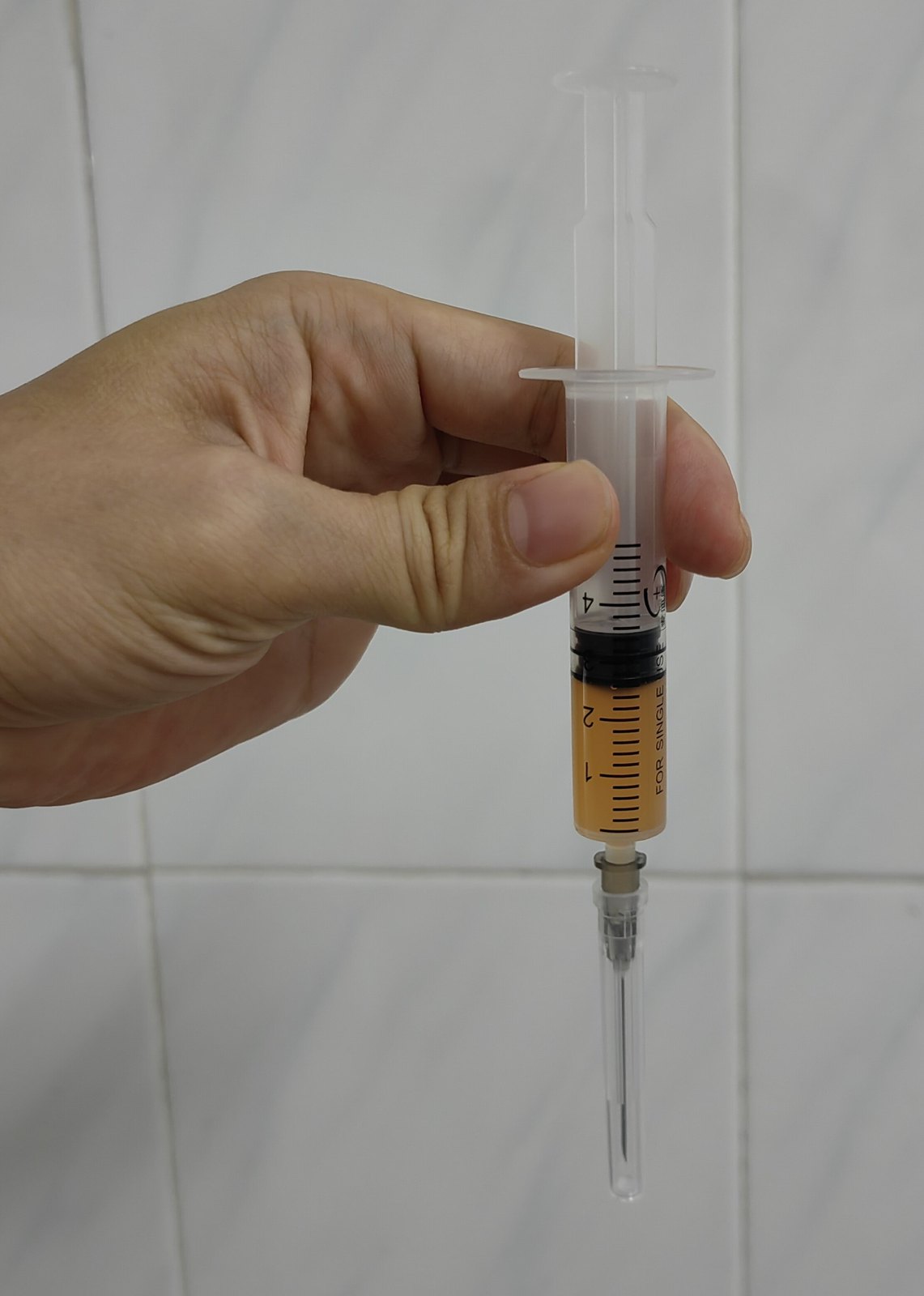 超声引导下富血小板血浆治疗腰椎间盘突出症有什么优点呢?