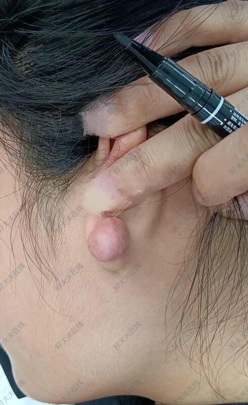 圖文圖片