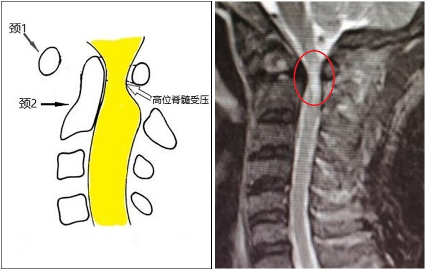 素描MRI组合图.jpg