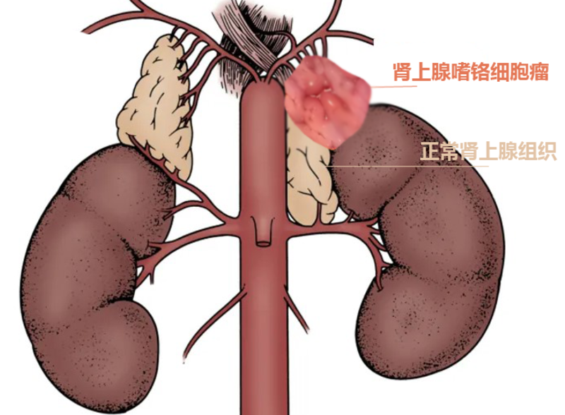 圖文圖片